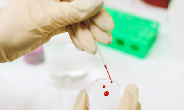 Estudo aponta ação do coronavírus na coagulação sanguínea